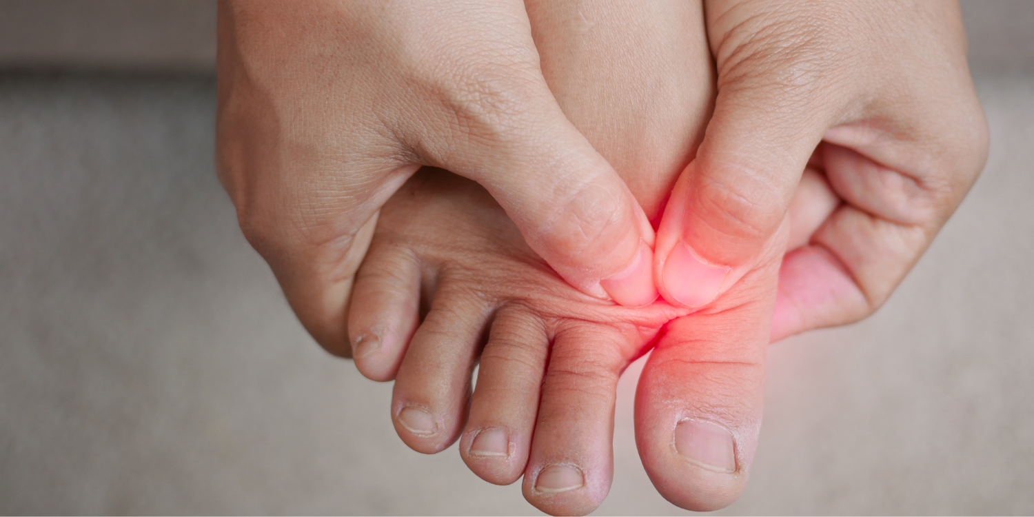 Reasons You’re Getting Big Toe Pain When Running | PhysioCentral