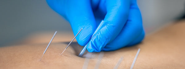 Jane Rooney – APA Level 1 Dry Needling